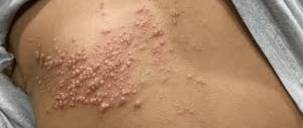 fot. https://www.gov.pl/